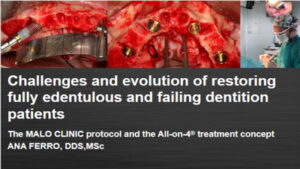 Challenges and Evolution of Restoring Fully Edentulous Patients