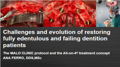 Challenges and Evolution of Restoring Fully Edentulous Patients 1 Challenges and Evolution of Restoring Fully Edentulous Patients