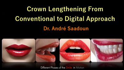 Crown Lengthening From Conventional to Digital Approach 1 Crown Lengthening From Conventional to Digital Approach