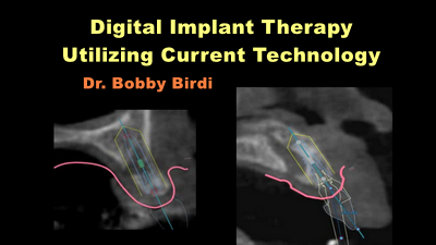 Digital Implant Therapy Utilizing Current Technology 1 Digital Implant Therapy Utilizing Current Technology