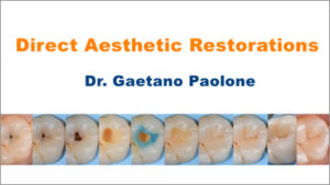 Direct Aesthetic Restorations