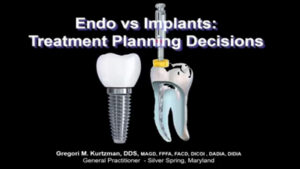 Endo vs. Implants: Treatment Planning Decisions