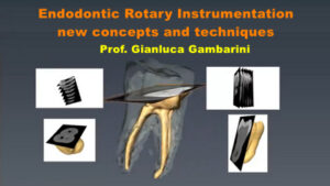 Endodontic Rotary Instrumentation: New Concepts and Techniques