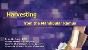 Harvesting from the Mandibular Ramus