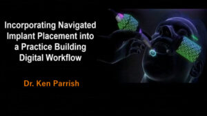 Incorporating Navigated Implant Placement Into a Practice-Building Digital Workflow