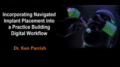 Incorporating Navigated Implant Placement Into a Practice-Building Digital Workflow 1 Incorporating Navigated Implant Placement Into a Practice-Building Digital Workflow
