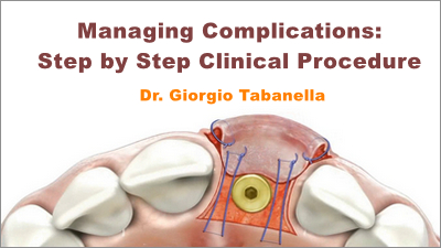 Managing Complications Around Implants: Step by Step Clinical Procedure 1 Managing Complications: Step by Step Clinical Procedure