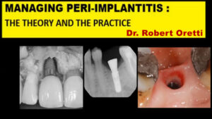Managing Peri-Implantitis: The Theory and The Practice