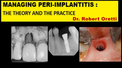 Managing Peri-Implantitis: The Theory and The Practice 1 Managing Peri-Implantitis: The Theory and The Practice