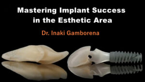 Mastering Implant Success in the Esthetic Area