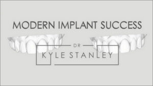 Modern Implant Success