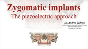 New Zygomatic Implant Minimally Invasive Technique Using Piezoelectric Strumentation