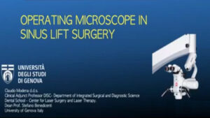 Operating Microscope in Sinus Lift Surgery
