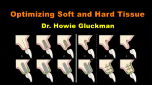 Optimizing Soft and Hard Tissue of Dental Implants