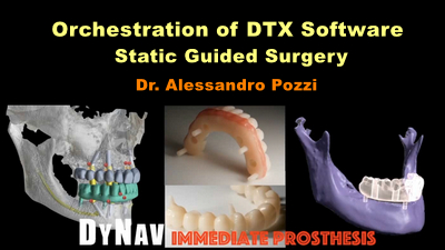 Orchestration of DTX Software: Static Guided Surgery 1 Orchestration of DTX Software: Static Guided Surgery