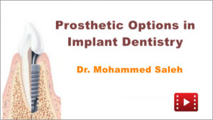 Prosthetic Options in Implant Dentistry