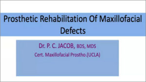 Prosthetic Rehabilitation of Maxillofacial Defects