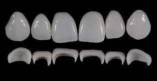 Prosthetic Rehabilitation on Natural Teeth: Predictable, Esthetic and Systematic Steps 1 Prosthetic Rehabilitation on Natural Teeth: Predictable, Esthetic and Systematic Steps
