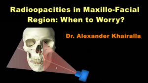 Radioopacities in Maxillo-Facial Region: When to Worry?