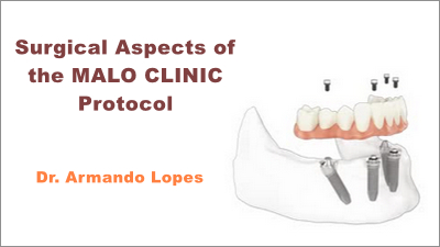 Surgical Aspects of the MALO CLINIC Protocol: From Standard to Zygoma Cases 1 Surgical Aspects of the MALO CLINIC Protocol