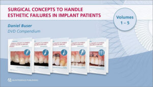 Surgical Concepts to Handle Esthetic Failures in Implant Patients