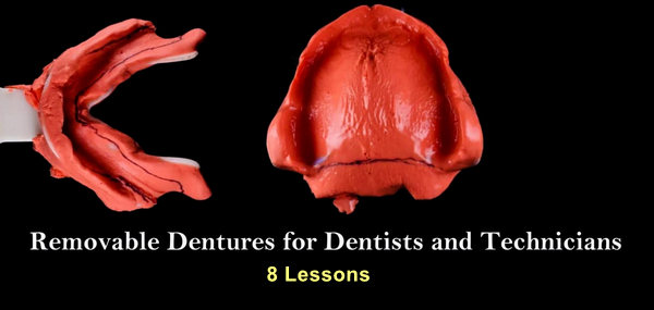 Removable Dentures For Dentists And Technicians Dental Videos