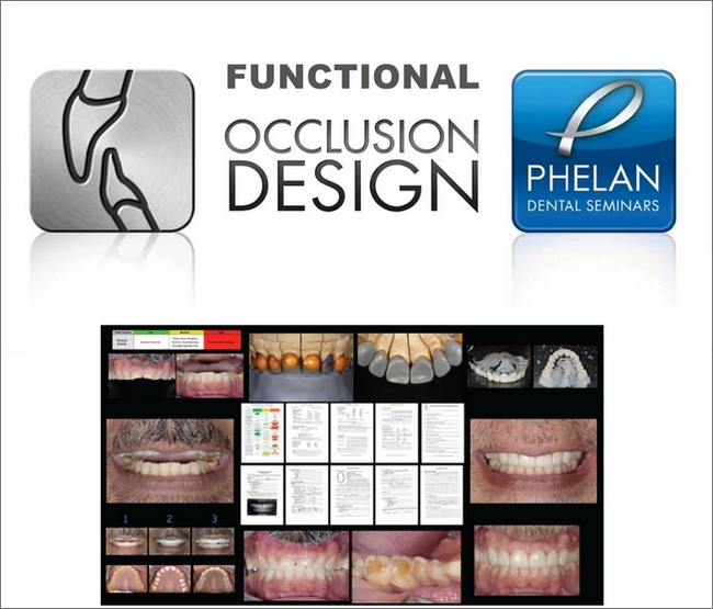 Functional Occlusion Design Dental Seminars (Full Bonus Package