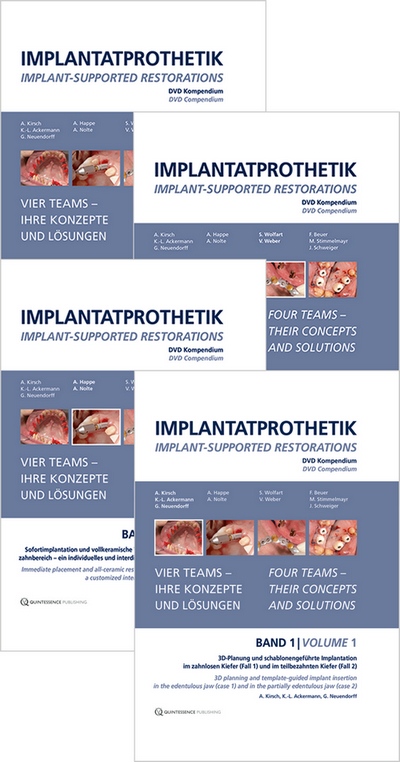 Implant-Supported Restorations - Vol. 1- 4 - (Video Course) 1 Implant-Supported Restorations - Vol. 1- 4 - (Video Course)