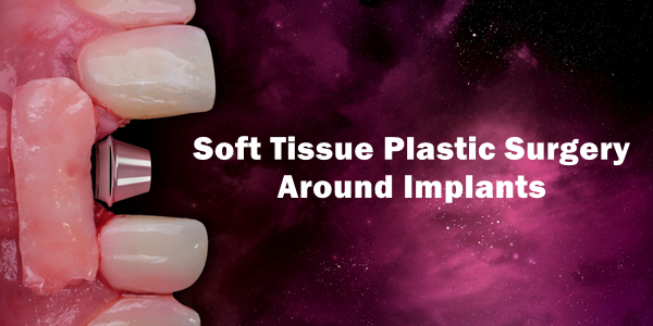 Soft Tissue Plastic Surgery Around Implants Dental Videos