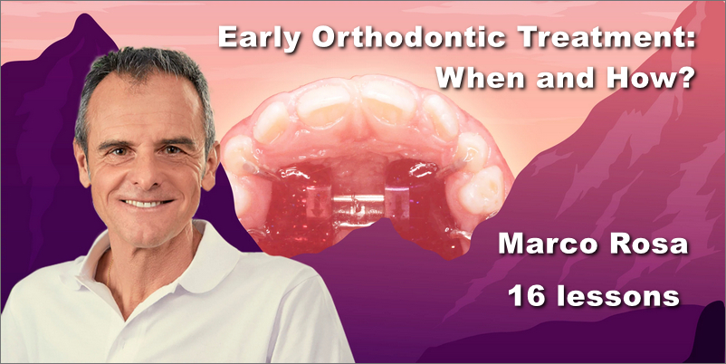 Early Orthodontic Treatment: When and How? 1 Early Orthodontic Treatment: When and How?
