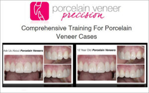 Porcelain Veneer Precision, Comprehensive Training for Porcelain Veneer Cases