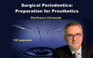Surgical Periodontics: Preparation for Prosthetics