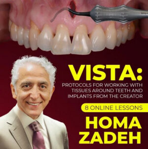 VISTA Technique: Protocols for Working with Tissues Around Teeth and Implants from the Creator