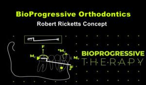 BioProgressive Orthodontics Therapy: Robert Ricketts Concept
