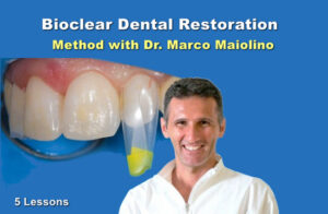 Bioclear dental restoration method with Dr. Marco Maiolino