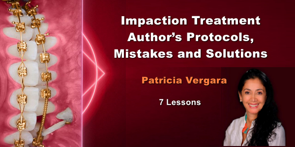 Impaction Treatment Author’s Protocols, Mistakes and Solutions 1 Impaction Treatment Author’s Protocols, Mistakes and Solutions