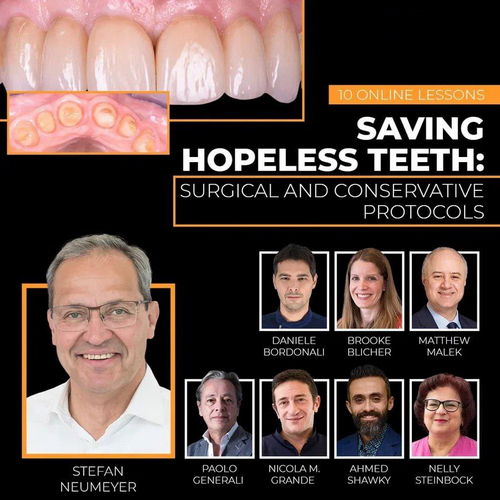 Saving Hopeless Teeth: Surgical and Conservative Protocols 1 Saving Hopeless Teeth: Surgical and Conservative Protocols