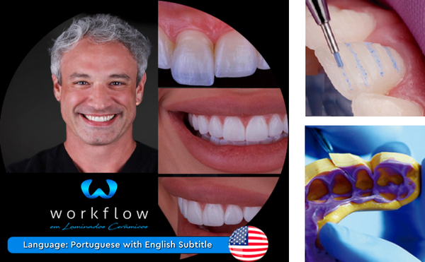 Ceramic Veneers Workflow 1 Ceramic Veneers Workflow