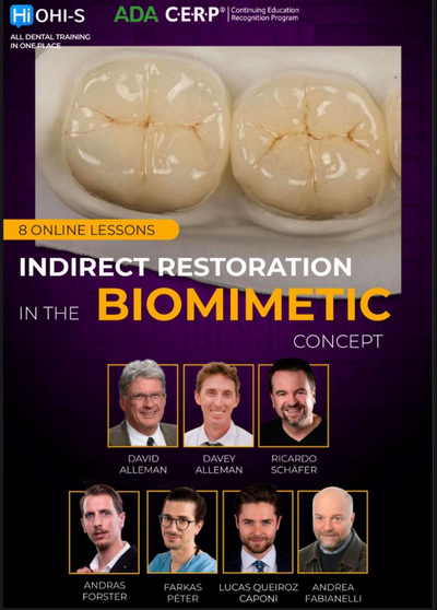 Indirect Restoration in the Biomimetic Concept 1 Indirect Restoration in the Biomimetic Concept