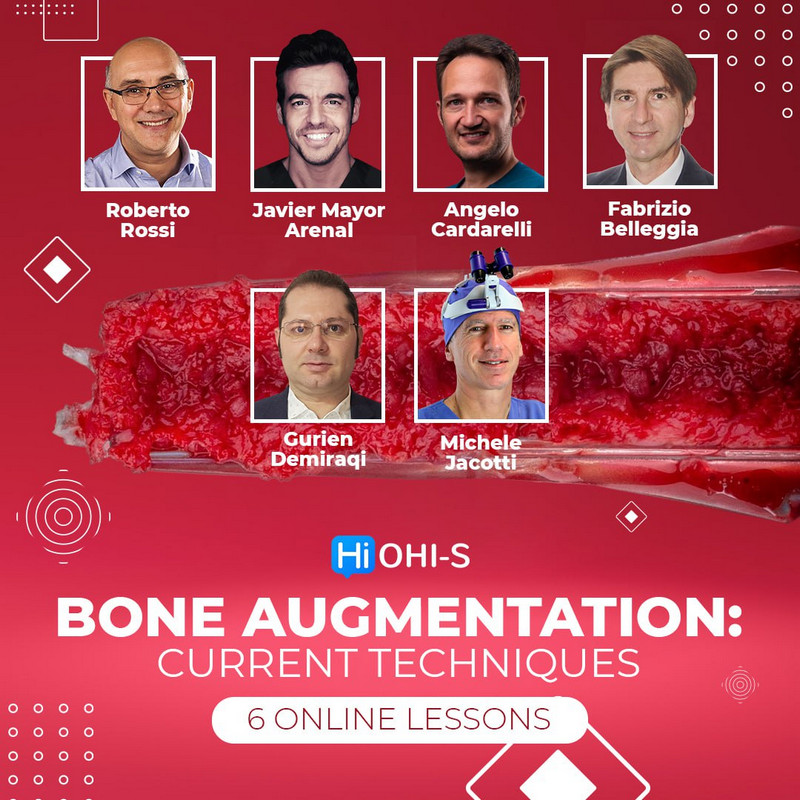 Bone Augmentation: Current Techniques 1 Bone Augmentation: Current Techniques