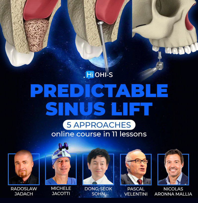 Predictable Sinus Lift Course Dental Videos Predictable Sinus Lift Course Dental Videos