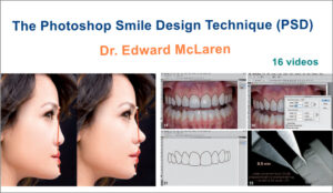 The Photoshop Smile Design Technique (PSD)