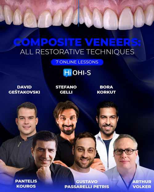 Composite Veneers: All Restorative Techniques 1 Composite Veneers: All Restorative Techniques