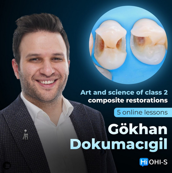 Art and Science of Class 2 Composite Restorations - Dental Videos