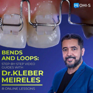 Bends and Loops: Step-by-step Video Guides - Dental Videos