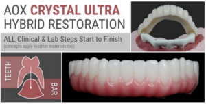 AOX Crystal Ultra Hybrid Restoration - ALL Clinical & Lab Steps Start to Finish