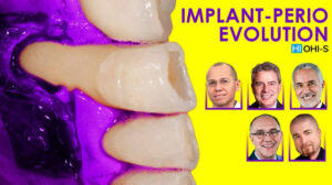 Implant-Perio Evolution: course of 10 webinars of implantology and periodontology