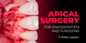 Apical Surgery for Endodontists and Surgeons