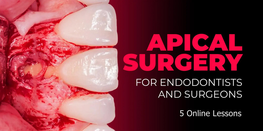 Apical Surgery for Endodontists and Surgeons 1 Apical Surgery for Endodontists and Surgeons
