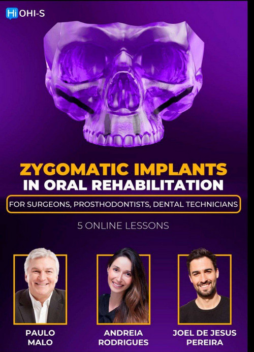 Zygomatic Implants in Oral Rehabilitation: For surgeons, prosthodontists, dental technicians 1 Zygomatic Implants in Oral Rehabilitation: For surgeons, prosthodontists, dental technicians